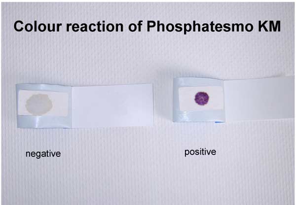 Sperma-Testpapier Phosphatesmo KM zum Nachweis der sauren Phosphatase, Dose a 2 Testpapiere 15 x 30 mm, 14 Stck an Lager